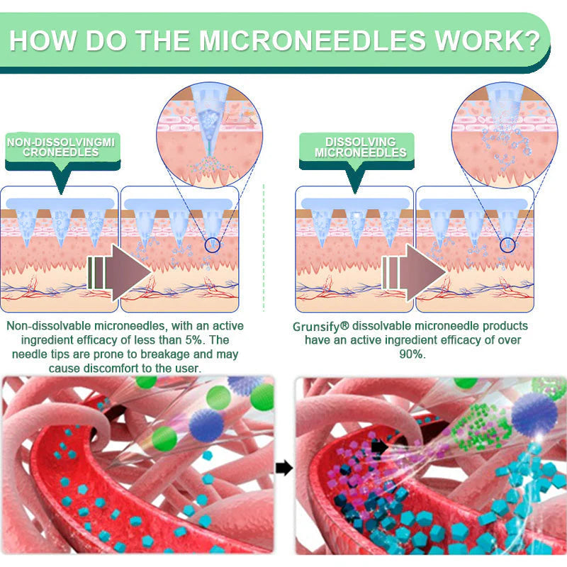 Tirzepatide Microneedle Patches ~ All-night craving control & natural weight support