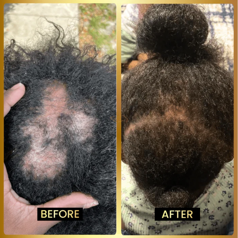 Jumbo Scalp Stimulator ~ Regrow, strengthen, and shine from the inside out.