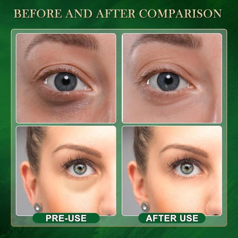 Avocado Collagen Eye Mask ~ Soothe puffiness and brighten tired eyes in minutes.