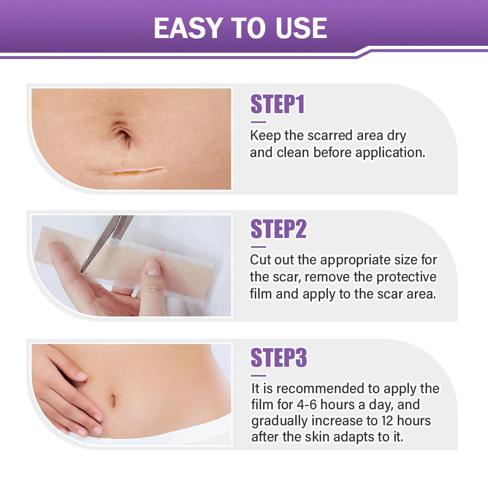 Skin Microneedle Repair Tape ~ Fade scars and stretch marks while you heal