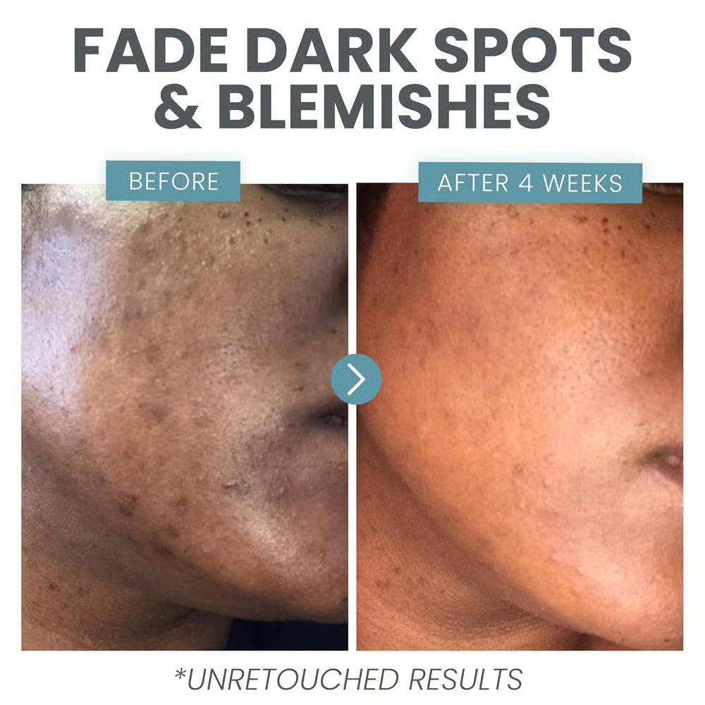 Vitamin C booster serum