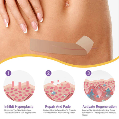 Skin Microneedle Repair Tape ~ Fade scars and stretch marks while you heal