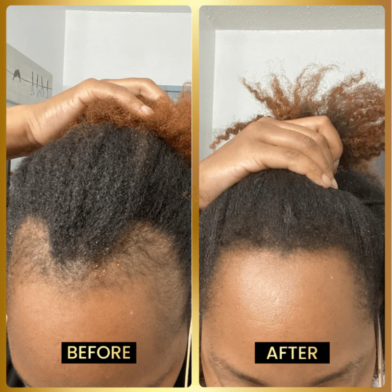 Jumbo Scalp Stimulator ~ Regrow, strengthen, and shine from the inside out.