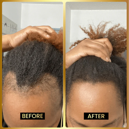 Jumbo Scalp Stimulator ~ Regrow, strengthen, and shine from the inside out.