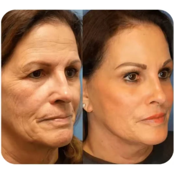Biomimic Foundation 4 in 1 ~ Flawless, Natural Coverage That Lasts All Day
