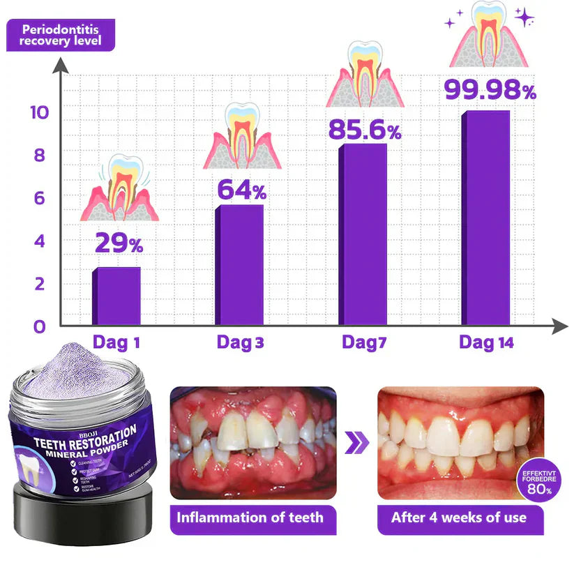 Teeth Restoration Mineral Powder ~ Strengthen enamel and repair micro-cracks