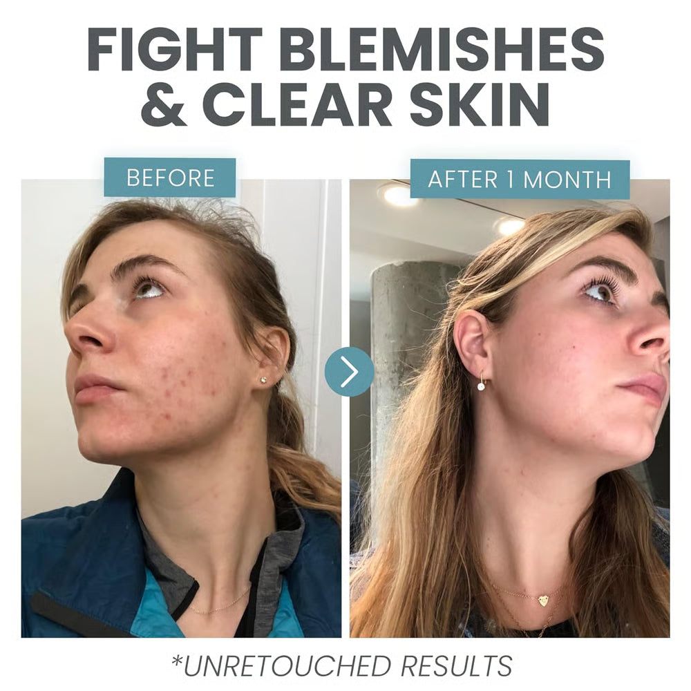 Vitamin C Booster Serum ~ Support glow by day and smoother skin at night.