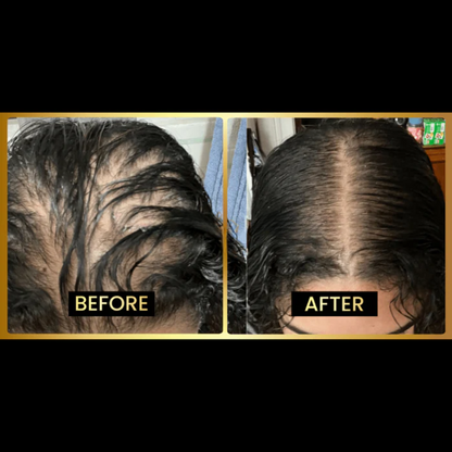 Jumbo Scalp Stimulator ~ Regrow, strengthen, and shine from the inside out.