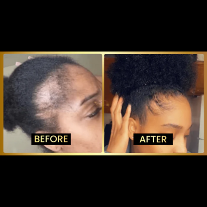 Jumbo Scalp Stimulator ~ Regrow, strengthen, and shine from the inside out.