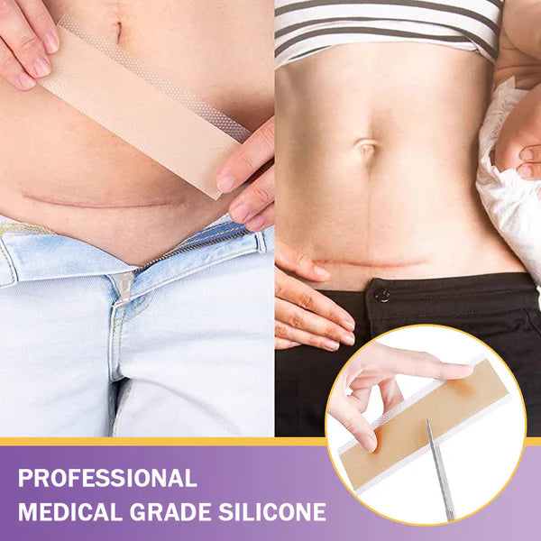 Skin Microneedle Repair Tape ~ Fade scars and stretch marks while you heal